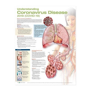 Wolters Kluwer Understanding Coronavirus Disease (COVID-19) Anatomical Chart - Understanding Coronavirus Disease 2019 (COVID-19) Anatomical Chart - 9781975165659