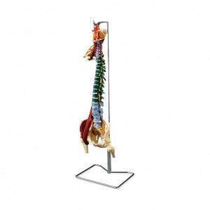 Wolters Kluwer Spine Models - Muscled Spine with Disorders Model - CH5900