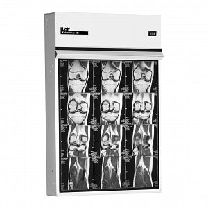 Wolf X-Ray X-Ray Illuminators - Trimline X-Ray Illuminator, Single, 14" x 17" - 21401