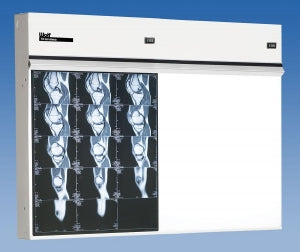 Wolf X-Ray X-Ray Illuminators - Trimline X-Ray Illuminator, 2 in 1 Horizontal - 21402