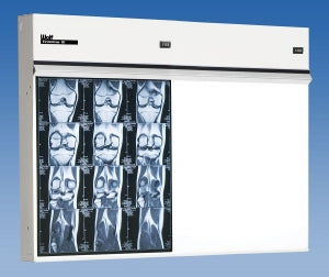 Wolf X-Ray Trimline III Illuminators - X-ray Trimline III Illuminator, 2 in 1 - 23402