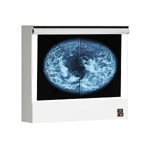 Wolf X-Ray VuPlus Mammography Viewer - Mammography X-Ray Illuminator, Single - 28001