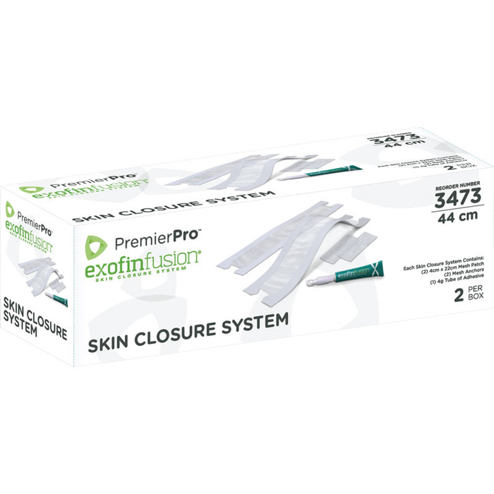 S2S Global Skin Closure Systems / Exofinfusion - TOPICAL, EXOFIN, FUSION, 30CM, W/GLUE - 3474