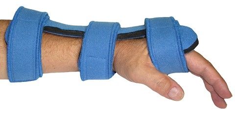 Splint Dorsal Hand Orthosis