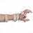 LMB Ulnar LMB Radial Nerve Splint with MP Extension and Adjustable Thumb Assist