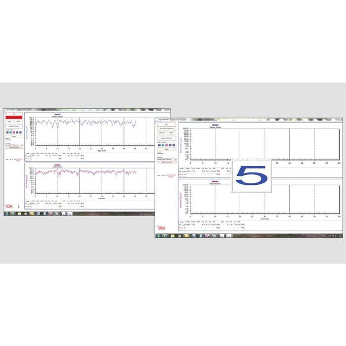 The Prometheus Group Pathway MR 20 and MR 25 EMG Units