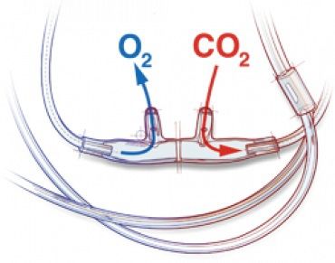 Pediatric Divided Nasal Cannula